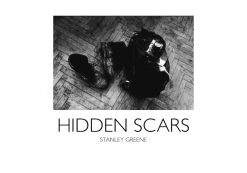 Stanley Greene Hidden Scars